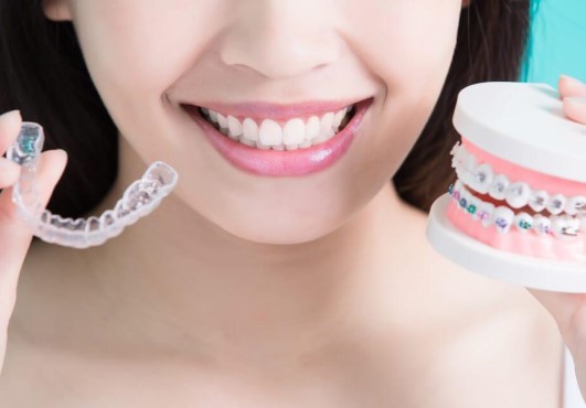 beneficios implante dental