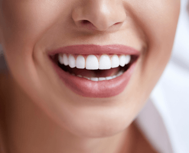 resultados implantes dentales