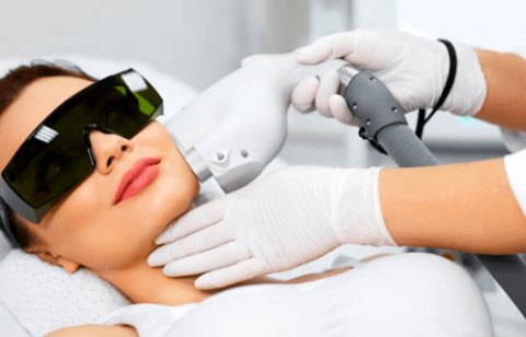 precio de laser en la cara