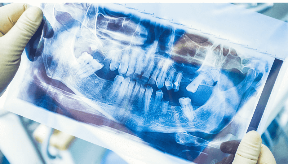 Radiografías dentales