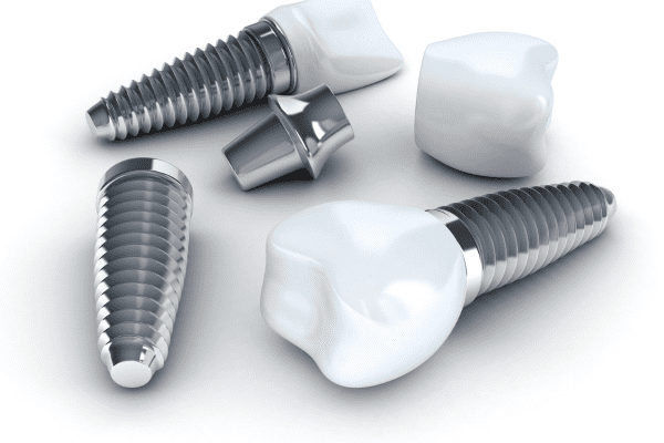 Implantes dentales, tipos y clasificación