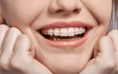 Precio ortodoncia, ofertas