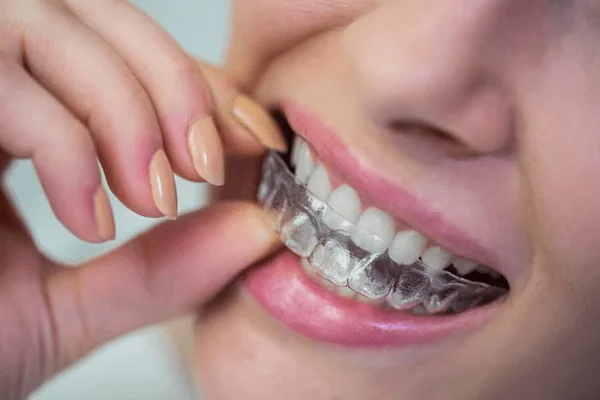 Invisalign Teen la ortodoncia de los adolescentes