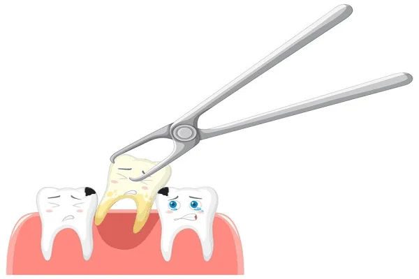 Qué son los dientes molares