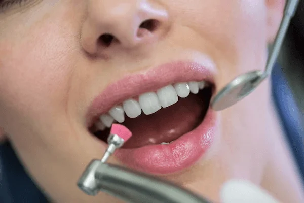 Uso del esmalte dental
