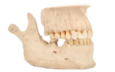 ¿Qué es el hueso maxilar?