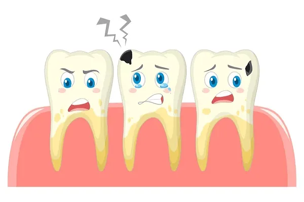 Tipos de Caries Dentales y su Volumen de Búsqueda