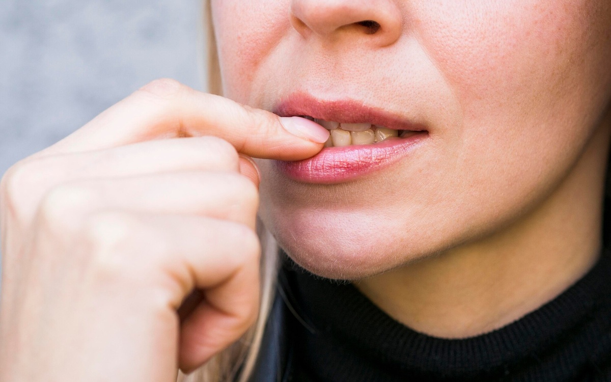 Cómo curar rápidamente una llaga en la boca