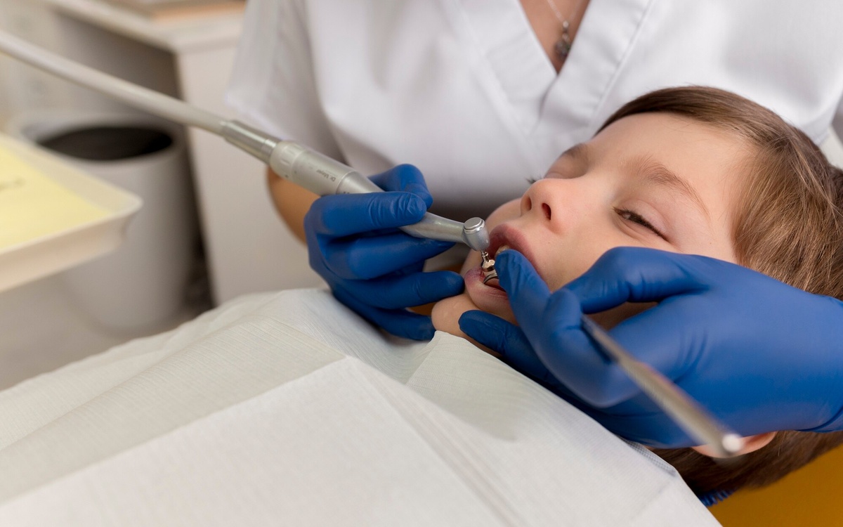 Fluorosis dental en niños