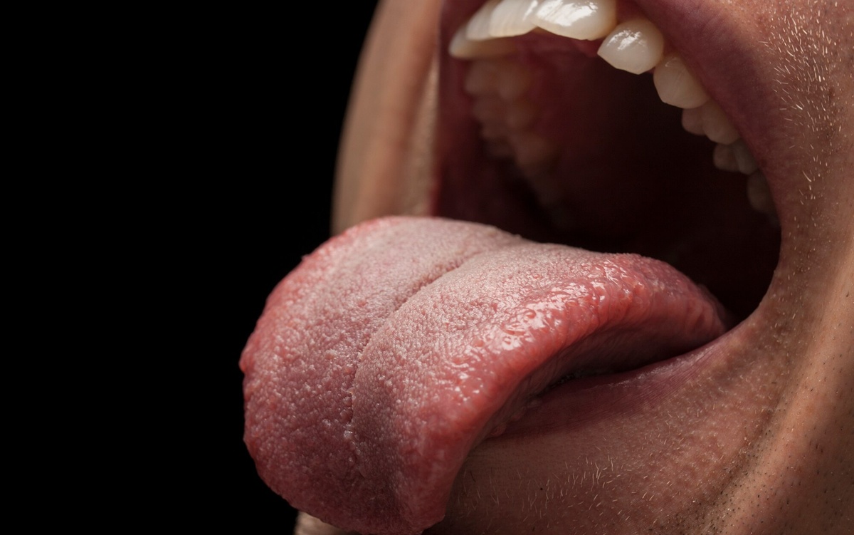 Puntitos en la lengua